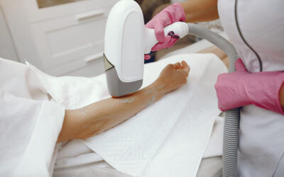 Laser Hair Removal in London: Say Goodbye to Unwanted Hair