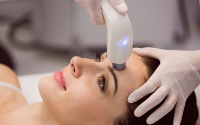 Laser Hair Removal in Birmingham: What You Need to Know