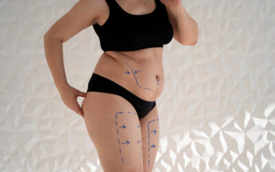 Medical Weight Loss in Birmingham: Treatments That Work