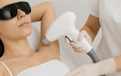 Laser Hair Removal in Solihull: The Complete Guide
